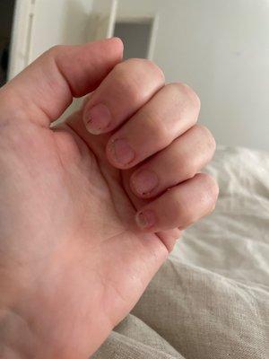 they completely ruined my nail beds