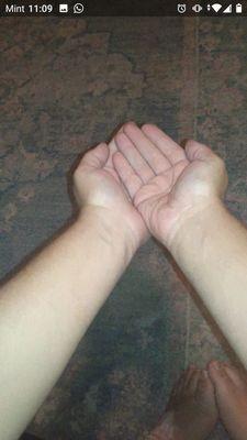 His Healing Hands and Feet