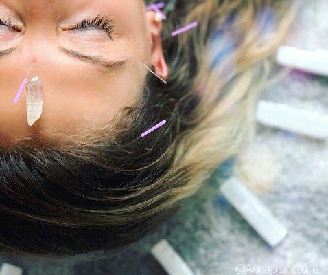Aurapuncture