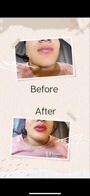 Before & After lip blushing