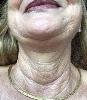 Don't go to AO Surgical Arts.