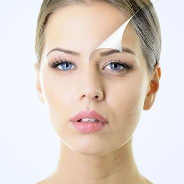 Anti-Aging Peel