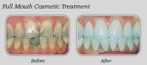 Gentle Care Family Dentistry