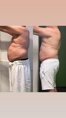 SkinTite Body Sculpting Spa