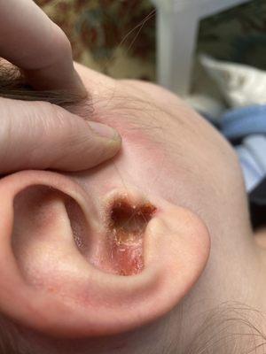 Child Protective Service