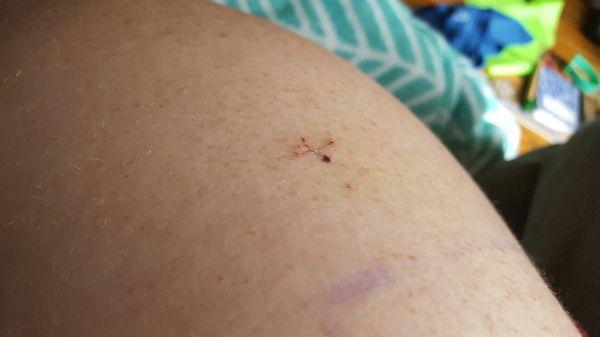 Crystal Clinic Physical Therapy Services