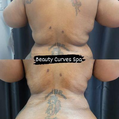Beauty Curves Spa