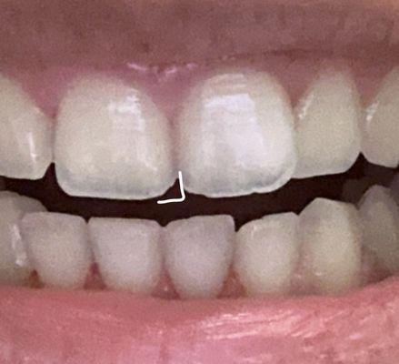 Dentistry For Children