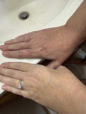 Ascension NE Wisconsin St. Elizabeth Hospital