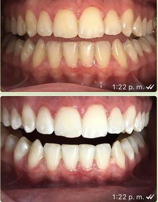 Lovely Eyebrows & Spa Sunny Isles