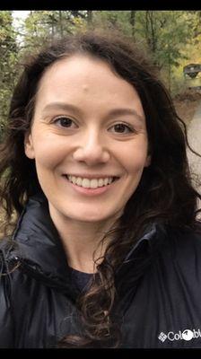 My before photo. A small cyst to my forehead.