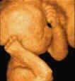 3d ultrasound newnan, ga. 4d ultrasound newnan, ga.