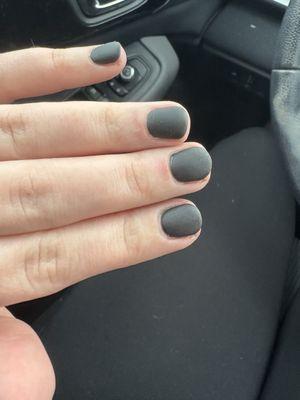 Brush burn on middle and ring finger