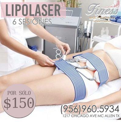 Lipolaser 
6 sesiones por $150