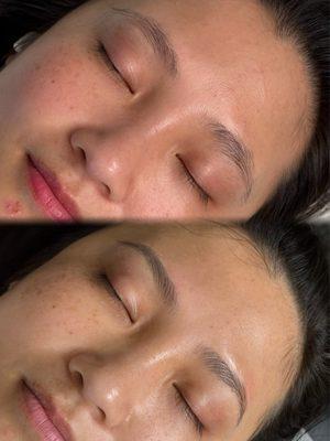 Before machine hairstrokes vs. healed+minor touchup