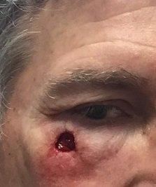 My insurance stated I was overcharged $953 by Posten, and the large hole he carved into my face wasn't supported by clinical medical info!