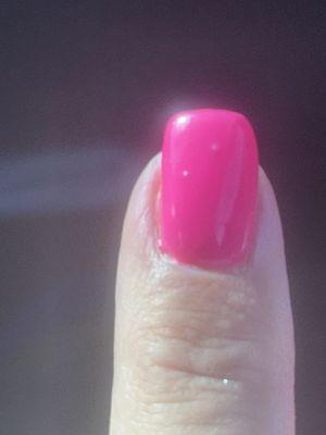 Pecks and uneven nail