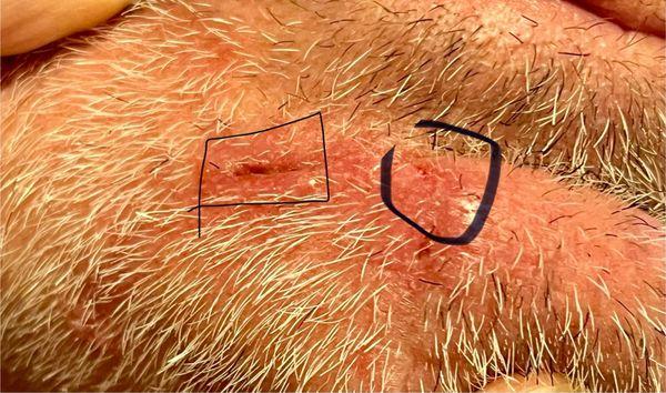 Redwood Family Dermatology