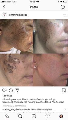 they posted on their instagram using Sophia phans photo from Heofflin Medical spa