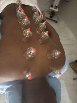 Yaz Permanent Hair Removal & Spa