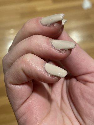 Botched acrylic nails