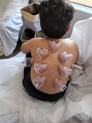 Lindsay Trottier, DACM LAC - Level Acupuncture