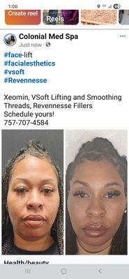 Colonial Med Spa And Family Practice