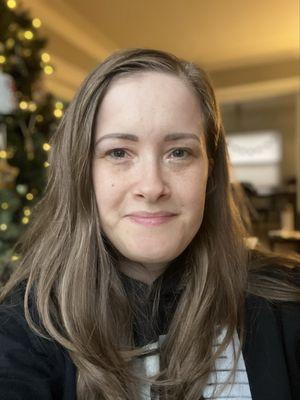 After - fully healed from both first visit and touch up visit. So natural looking and wonderful match to my natural hair color.