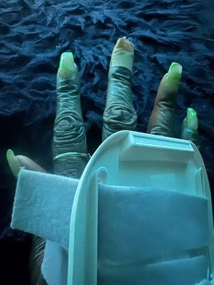 See the middle finger taped up cause the damage broke blood