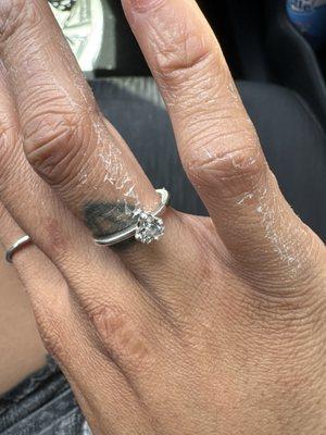 acetone all over my hands
