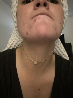 American Skin Institute