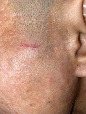 She also left a scar