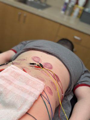 Rivernorth Acupuncture