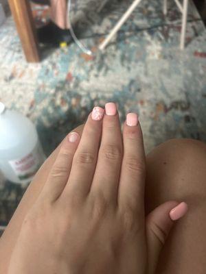 after 4 days my nail fell off
