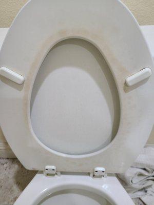 Toilet seat. Never seen cleaning agent, eh.