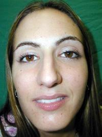 James D. Schlenker, MD