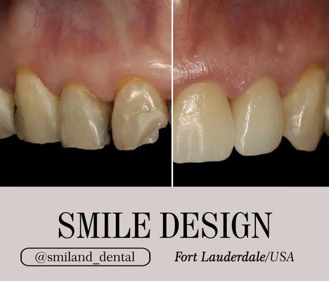 Smiland Dental Fort Lauderdale