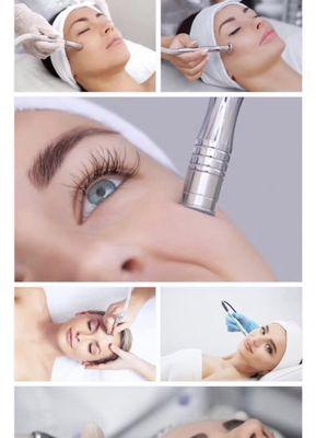 Microdermabrasion Treatment