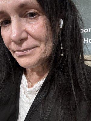 K Cary Canoun, M.D., F.A.C.S