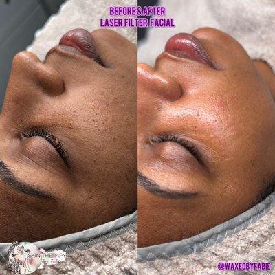 Skin Therapy By Fabie