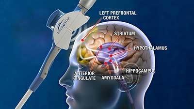 Prime Behavioral Health