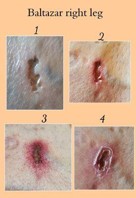 Center for Vein Restoration