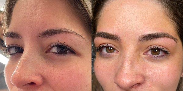 Before and after Combo Brows