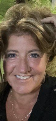 60 is not so bad!
No more wrinkles on forehead, nose and few around eyes.