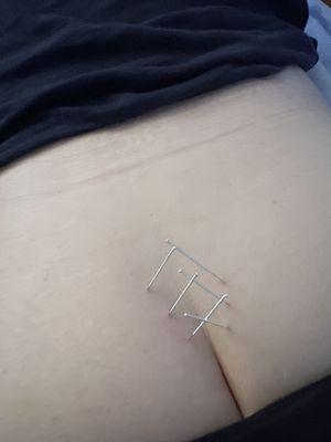 Better Health Acupuncture & Herbs