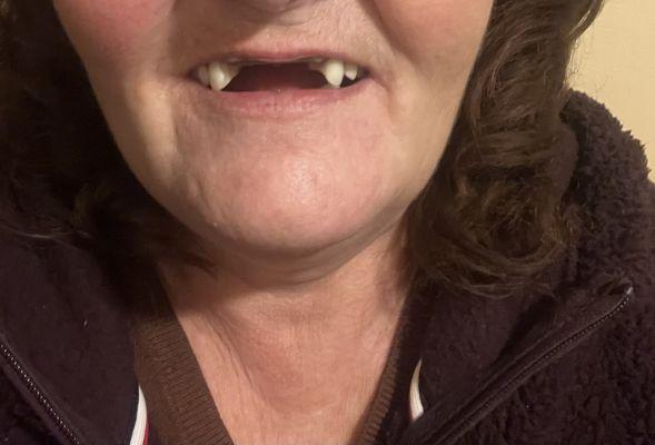 Peter F Johnson, DMD