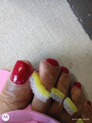 Big toe where she try to fix polish that sneared
