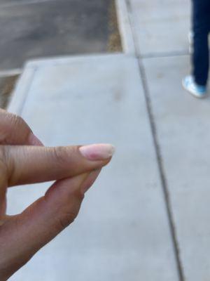 She filed my mail so close to the skin that is red and it hurts.