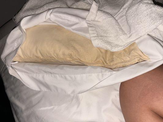 Moldy pillows