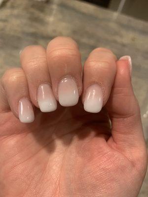 The other hand.. you can see the same substance on my skins around my nails here